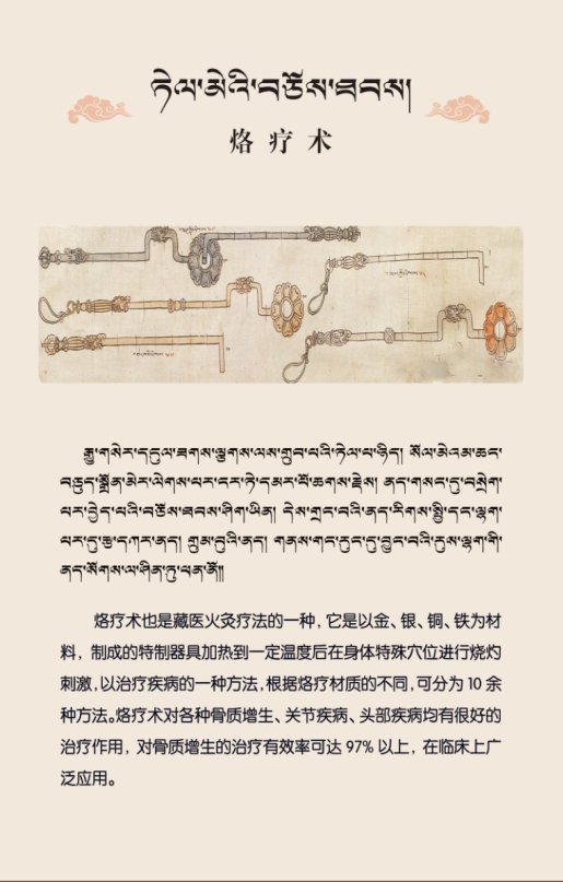 藏醫(yī)特色外治療法—烙療法